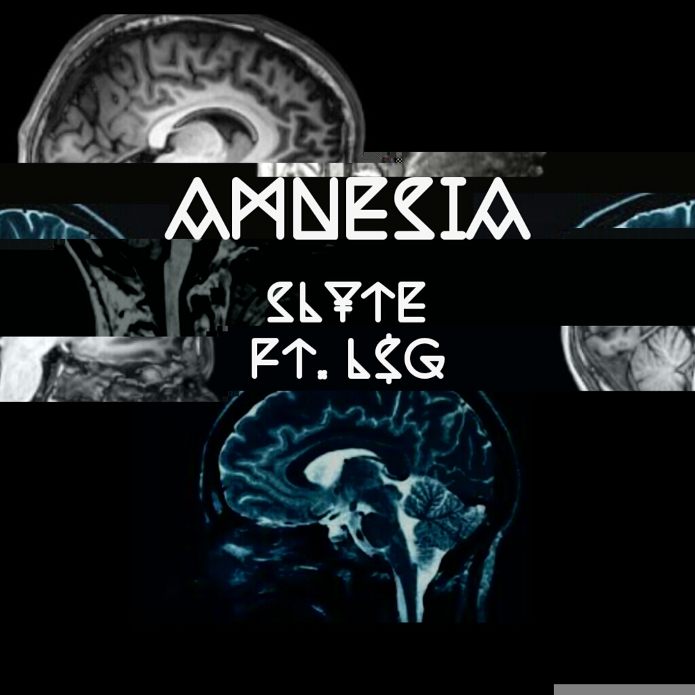Amnesia