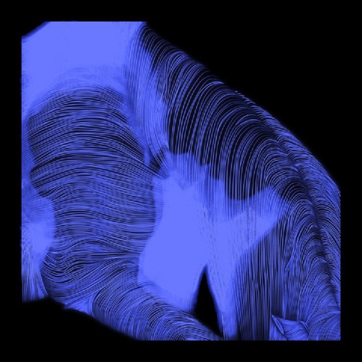 [|] (Brackets) (20 Minute Mix)