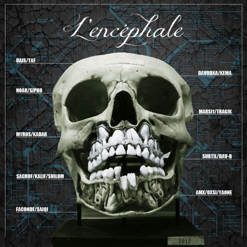 L'encéphale