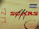 Scars